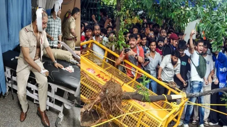 Injured Delhi Police Inspector Describes Violent Assault During CJP Protest