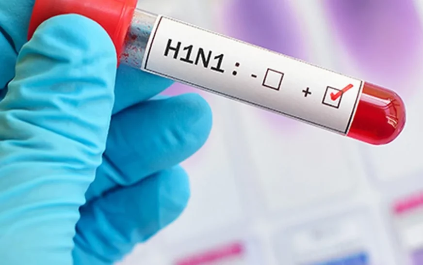 H1N1 Influenza: Why Cases Rise and How the Virus Spreads