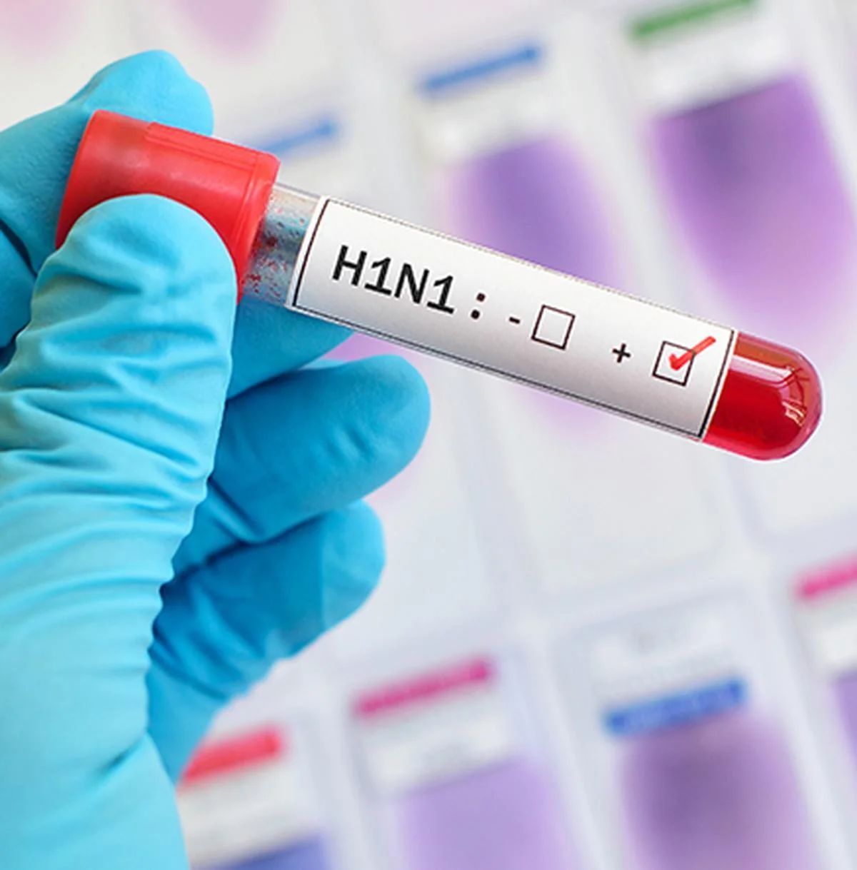 H1N1 Influenza: Why Cases Rise and How the Virus Spreads